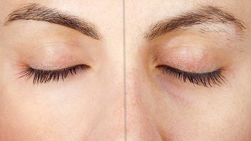 Mau Punya Kulit Lebih Halus? Simak 6 Tips Hilangkan <i>Crepey Skin</i>